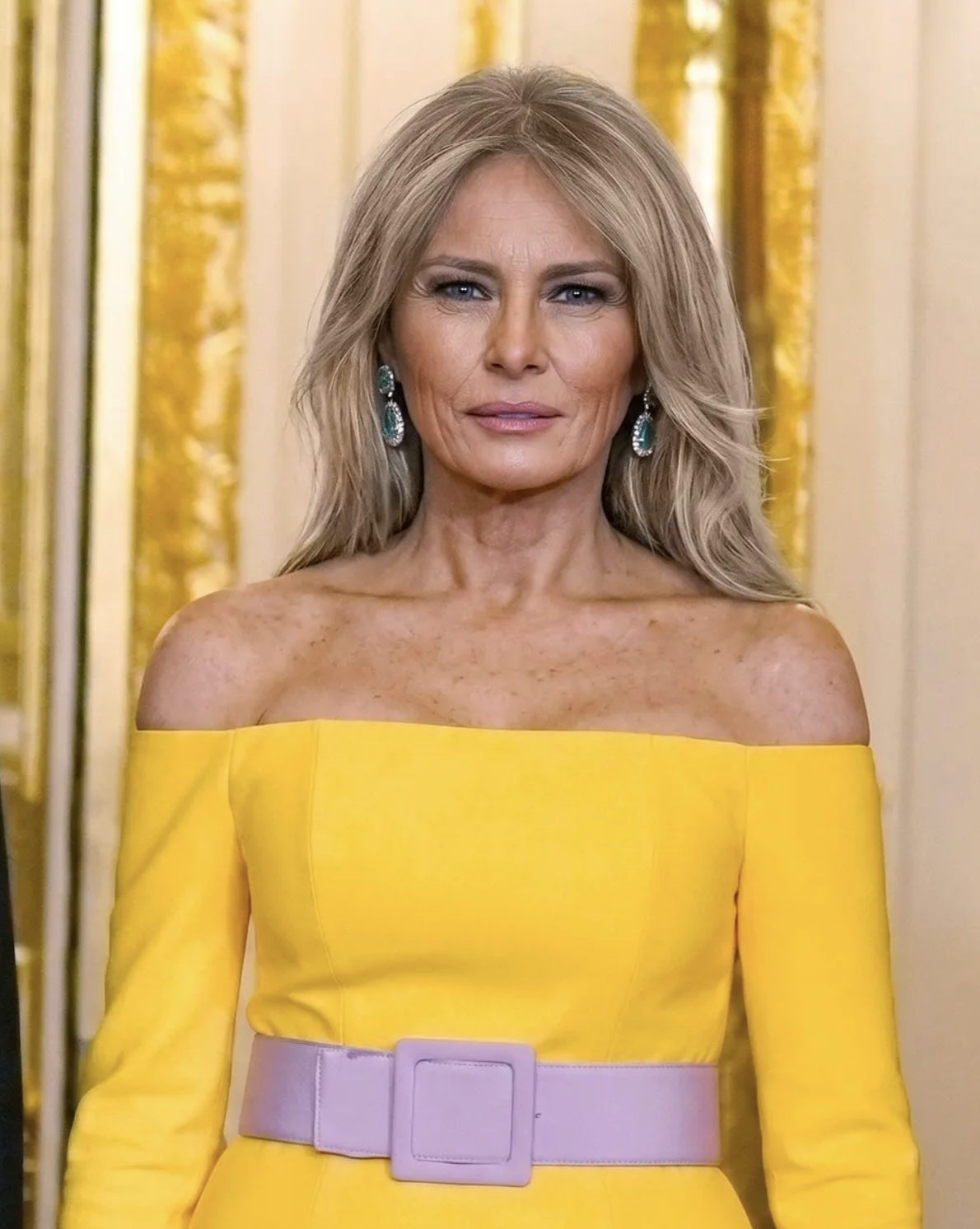 Trump said she opposed Botox and injections and intended to "age gracefully." Those statements represent her account of her appearance and cosmetic history. | Source: ChatGPT