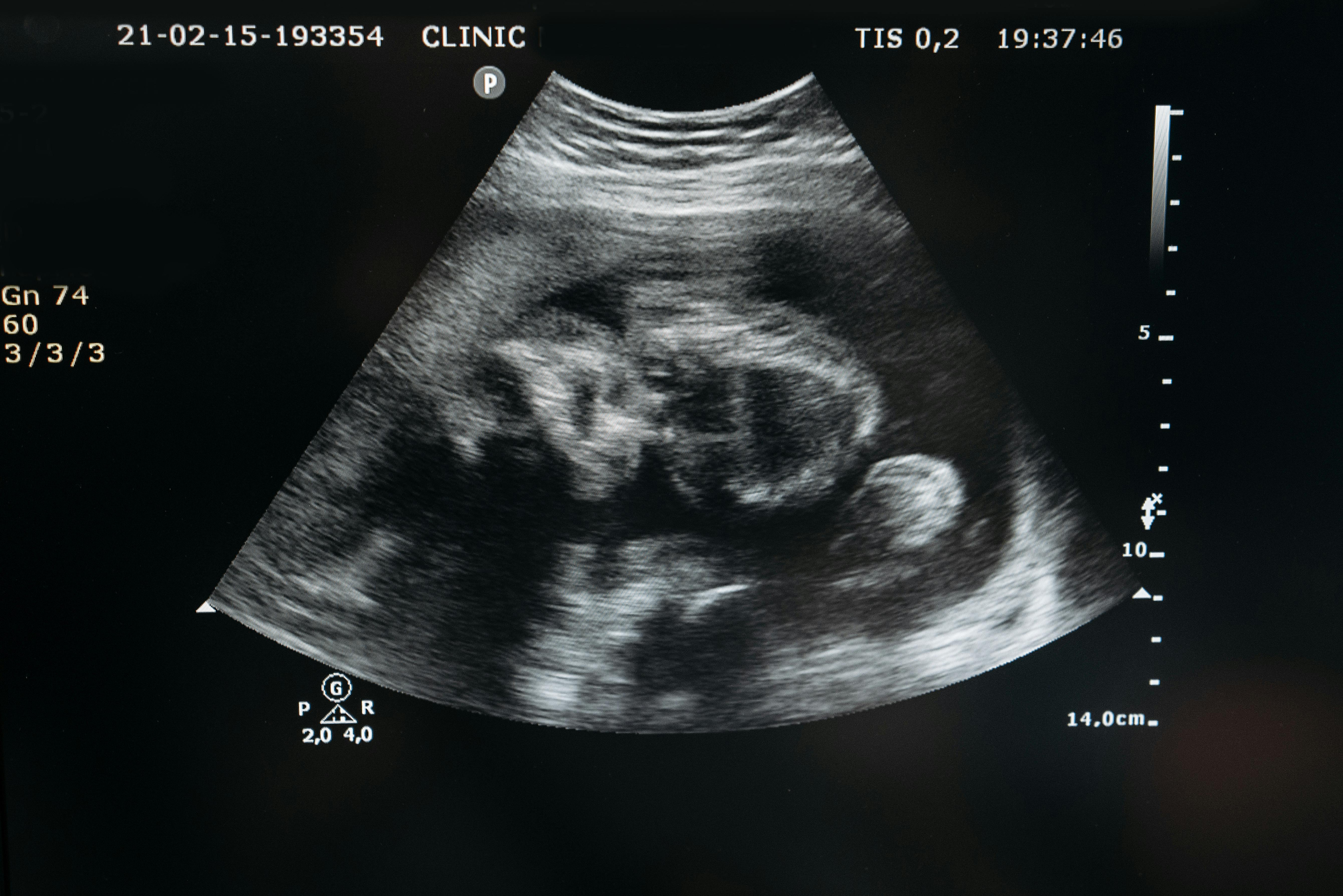A close up of a sonogram | Source: Pexels