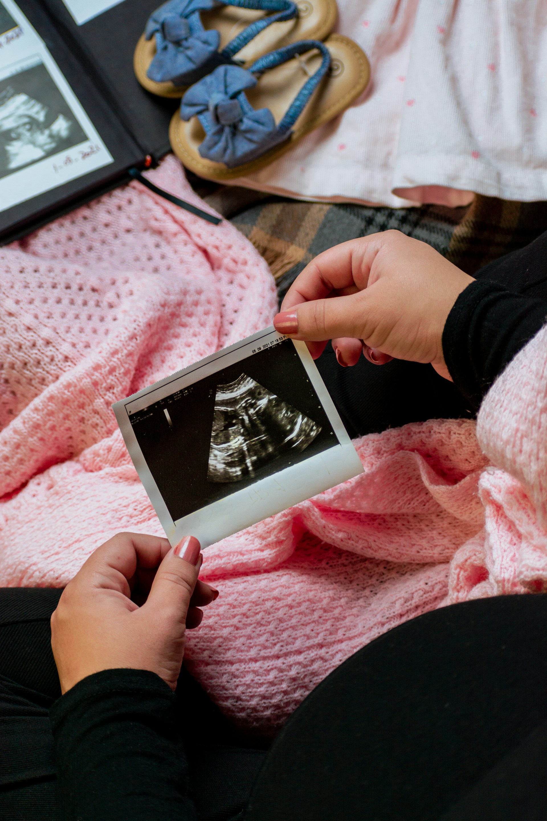 A pregnant woman looking at an ultrasound scan image | Source: Unsplash