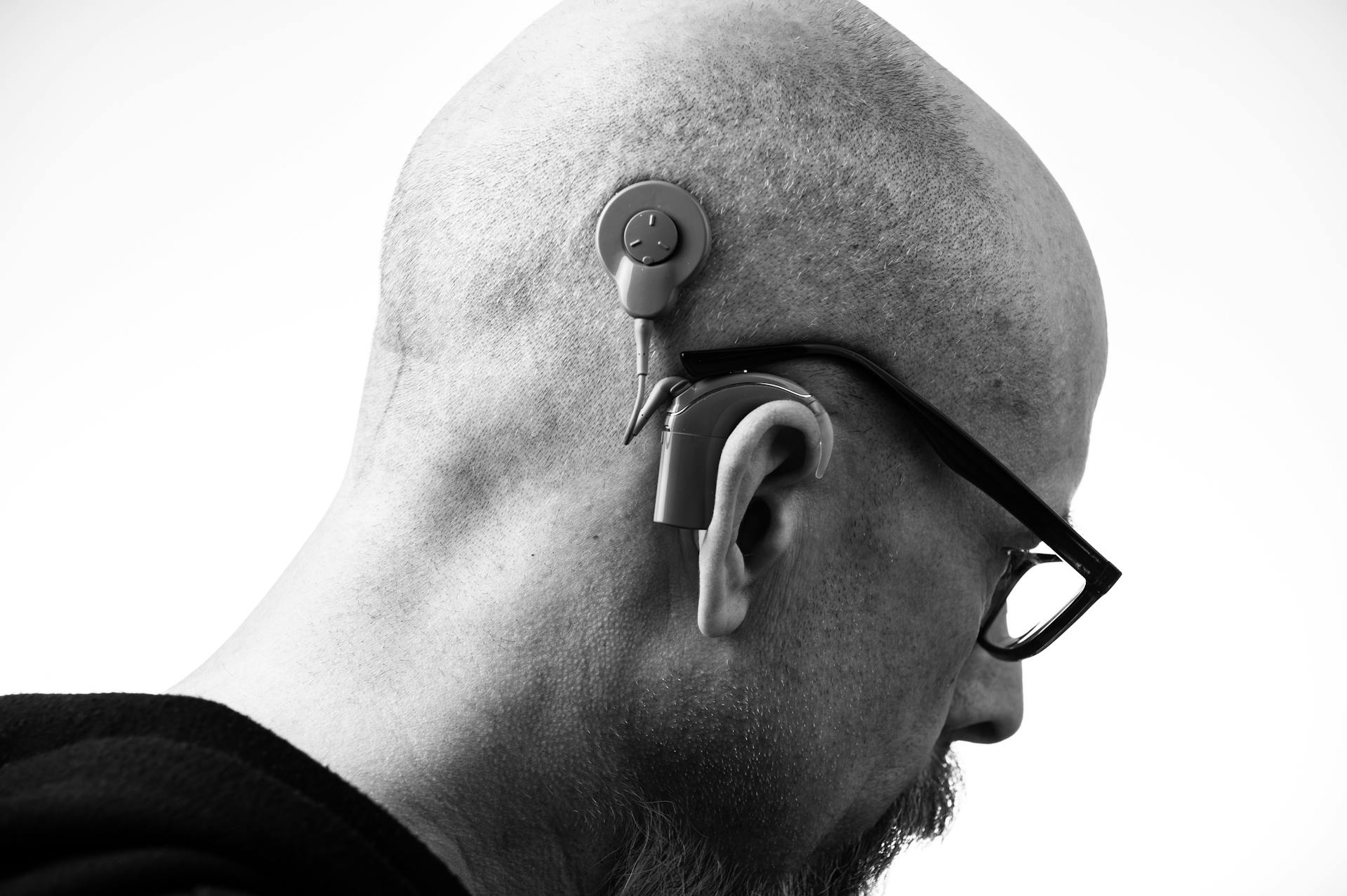 A man with a hearing aid | Source: Pexels