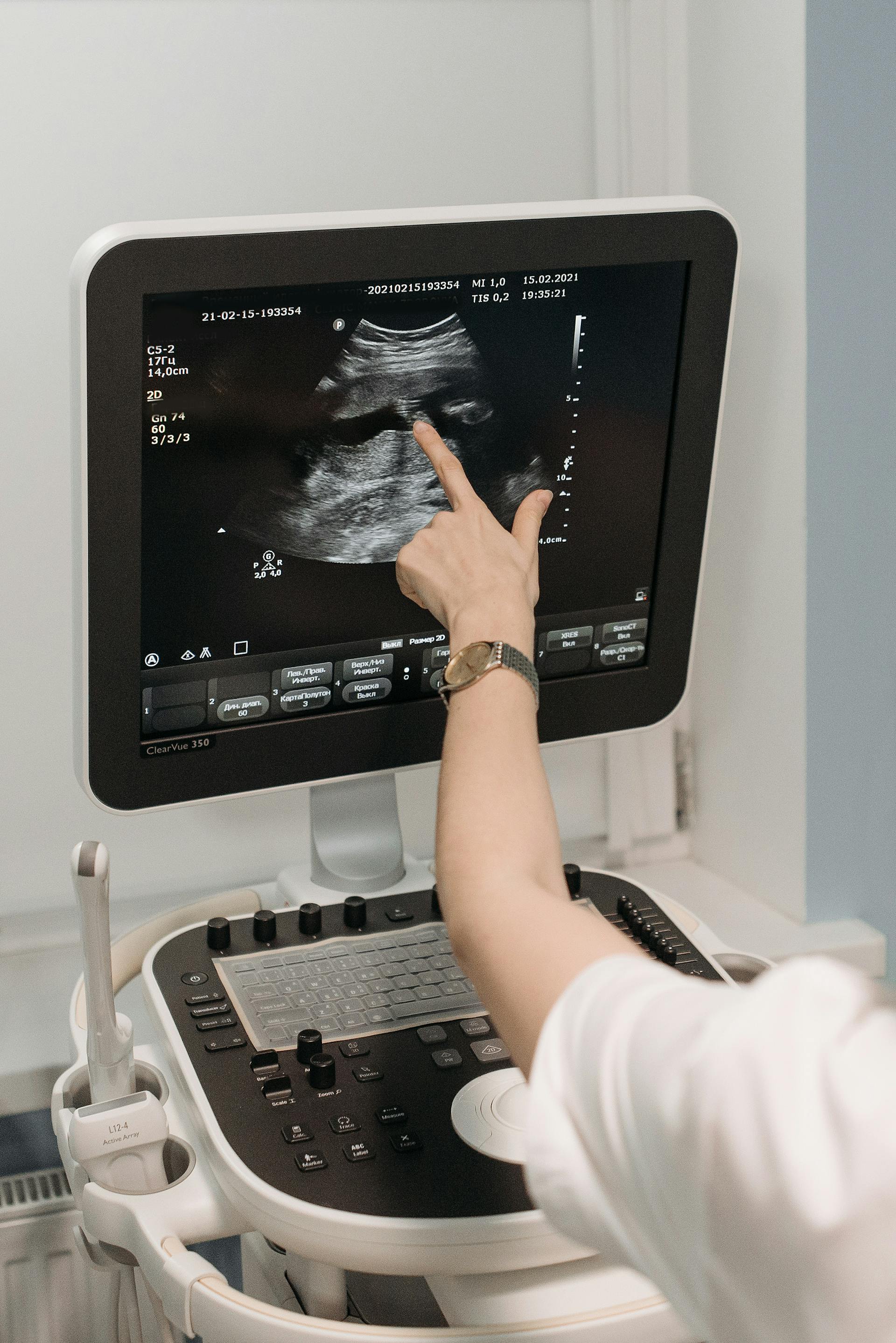 A sonographer touching the ultrasound screen | Source: Pexels