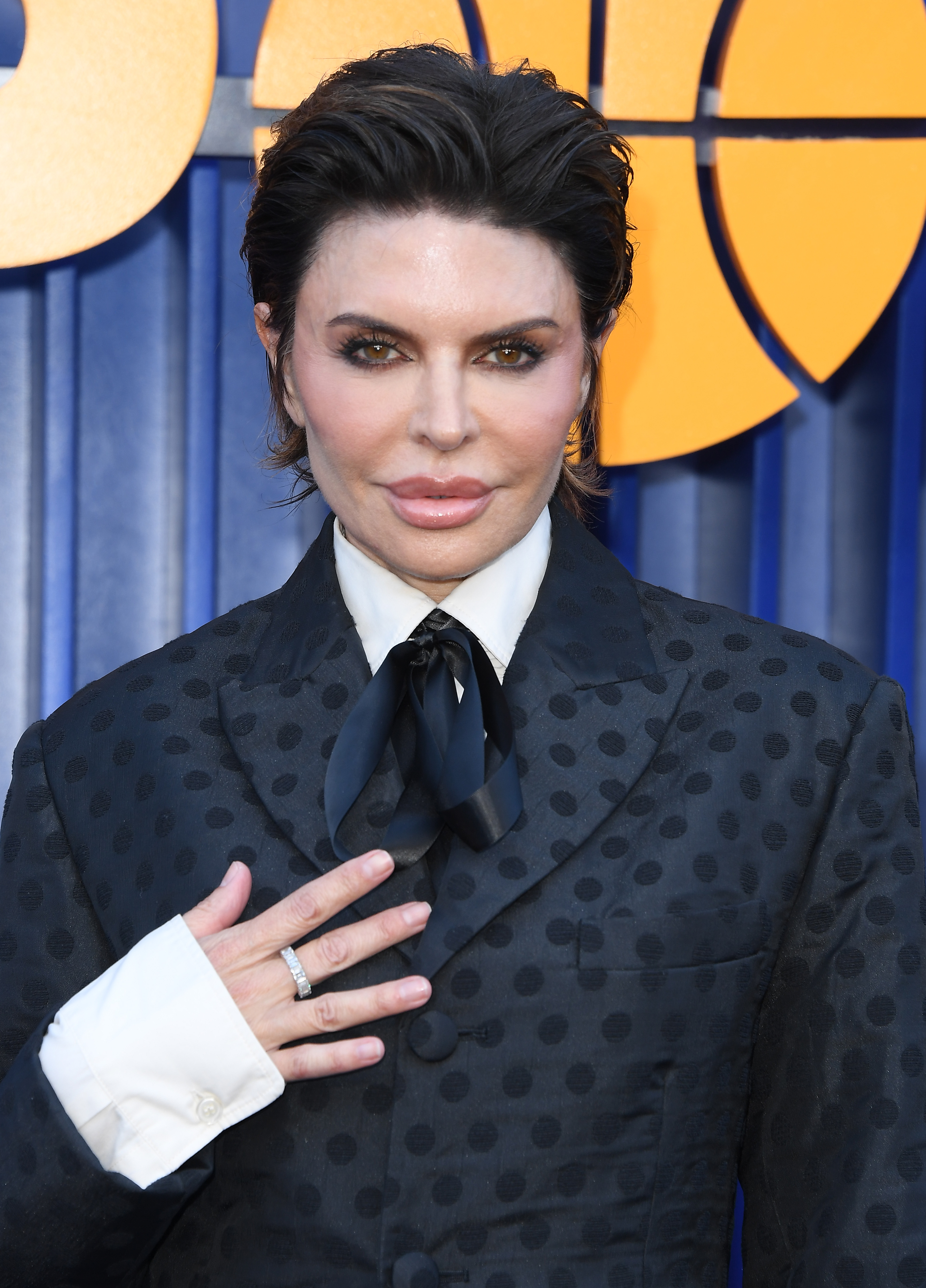 This 2026 photo of Rinna was taken after she said the effects of SKINVIVE had been reversed and her face returned to normal within days. The experience became another part of the cosmetic treatment history she has discussed publicly. | Source: Getty Images