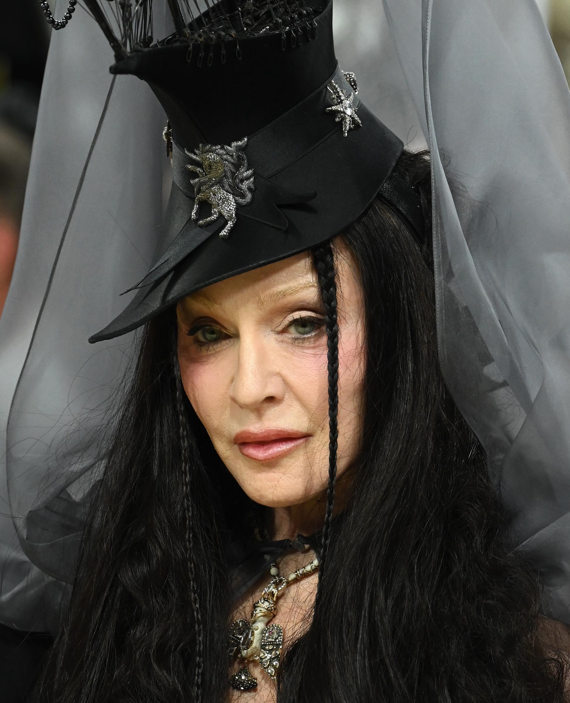 Madonna is pictured in 2026. In 2025, a source told Page Six that the singer wanted to embrace a more natural appearance and "look less sculpted," though Madonna has not publicly confirmed making any specific change to her fillers. | Source: Getty Images