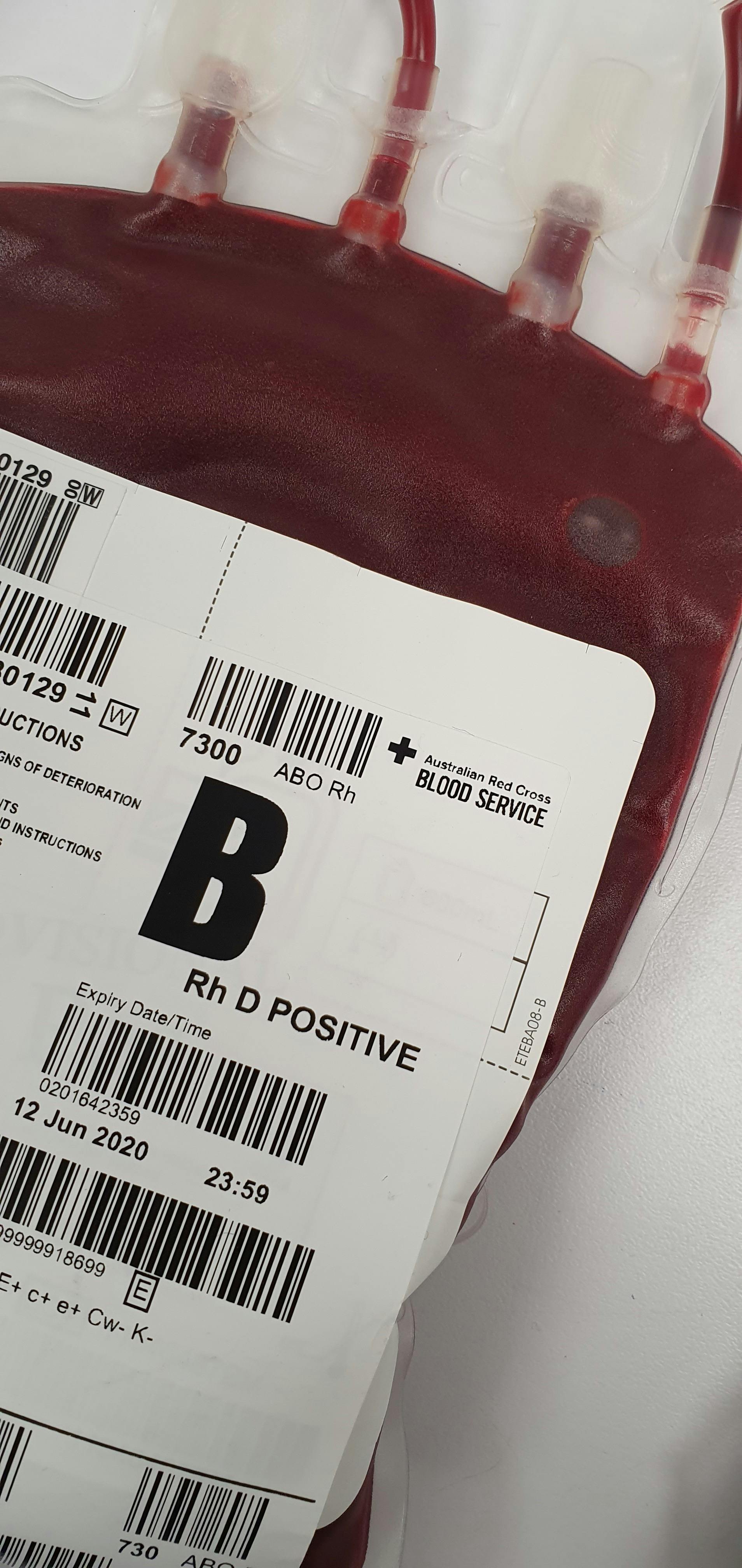 A close-up of a blood bag | Source: Pexels