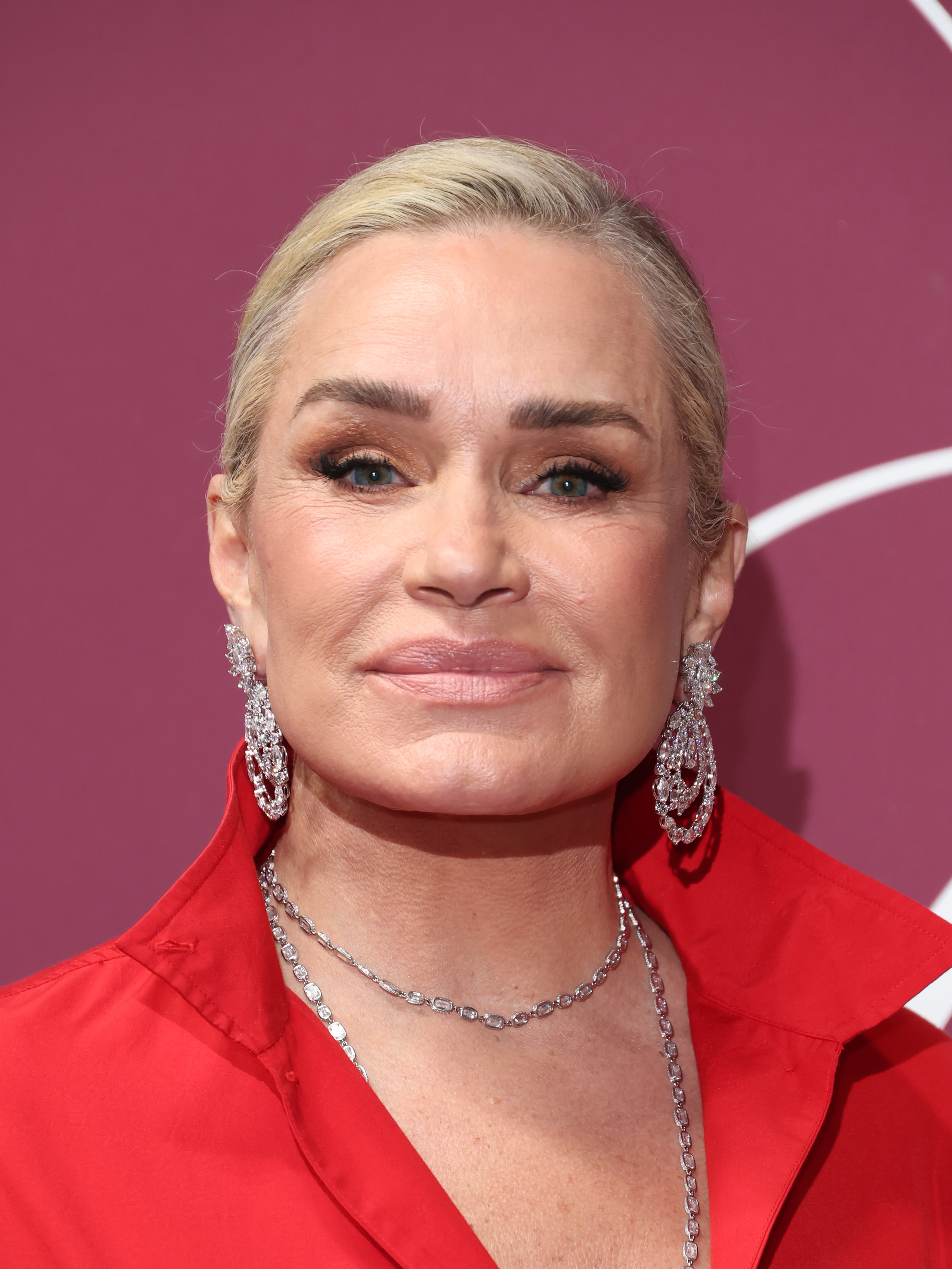 By 2026, Hadid had spent years living without the fillers and Botox she previously discussed. She described those changes as part of a broader shift toward prioritizing her health and defining beauty on her own terms. | Source: Getty Images